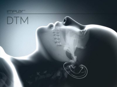 implante dentario preço