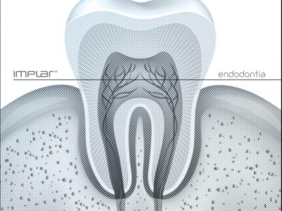 implante dentario