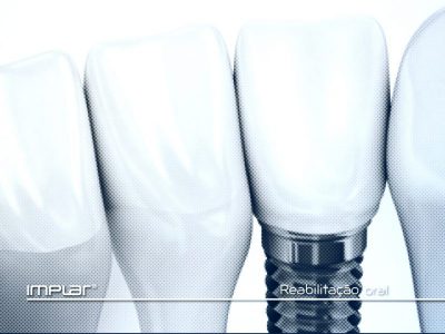 implante dental